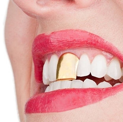 دندان-طلا-آرتمیس-گلد
